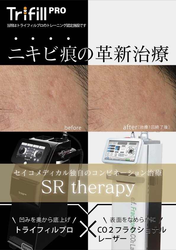 ニキビ痕の革新治療「SRtherapy」はセイコメディカル独自のコンビネーション治療です
