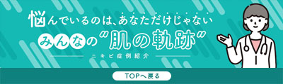 悩んでいるのはあなただけじゃない　みんなの肌の軌跡　ニキビ症例紹介