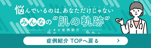 ニキビ症例紹介TOPへ戻る