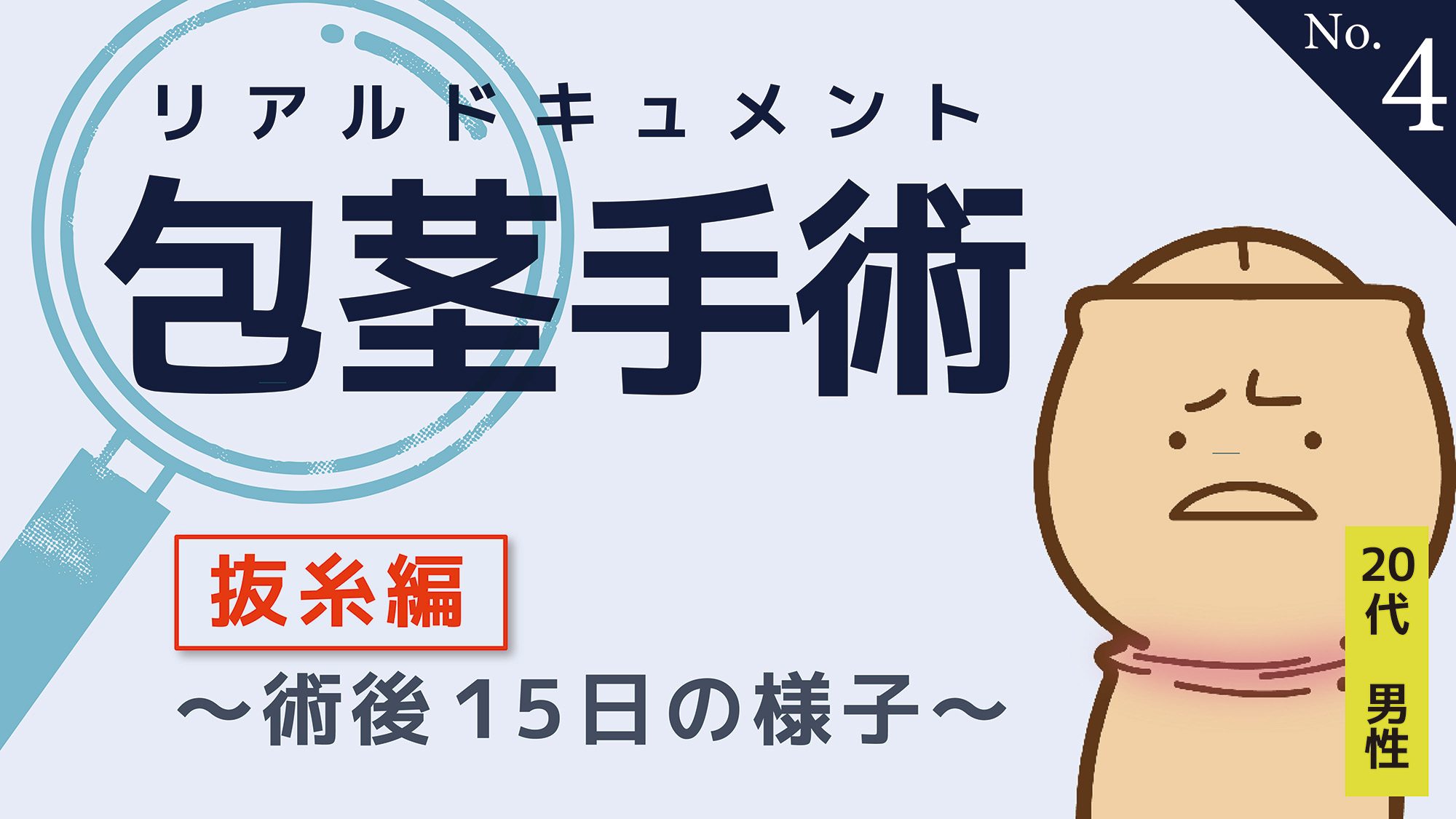 抜糸編 ～術後１５日の様子～ | 包茎手術リアルドキュメント カルテNo,4｜ セイコメディカルビューティクリニック