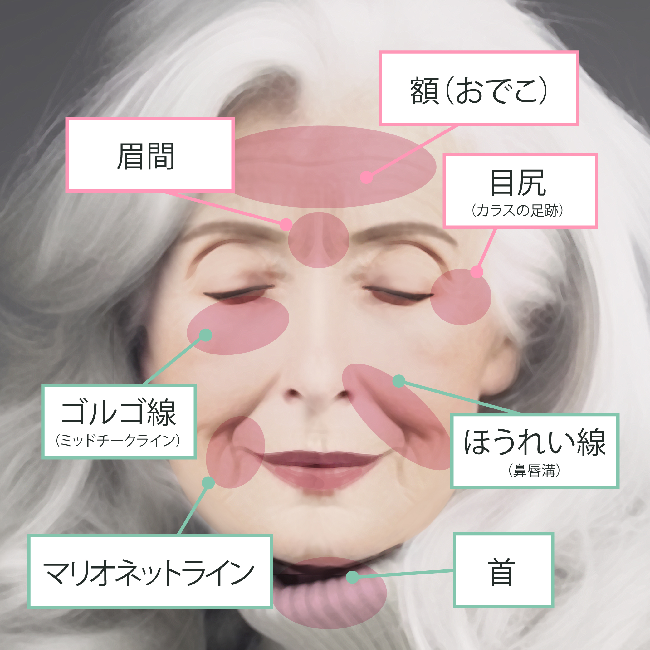 しわ たるみ