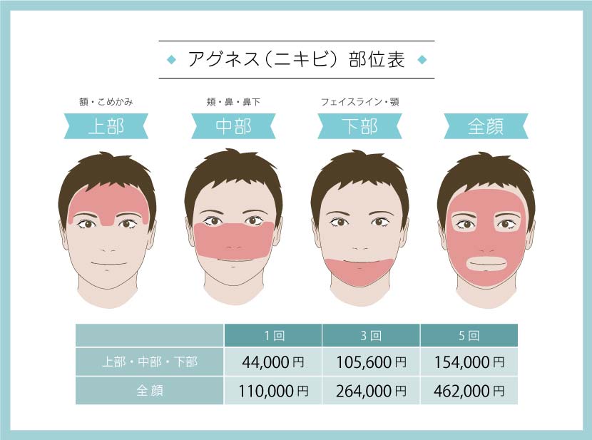 アグネス部表・価格表