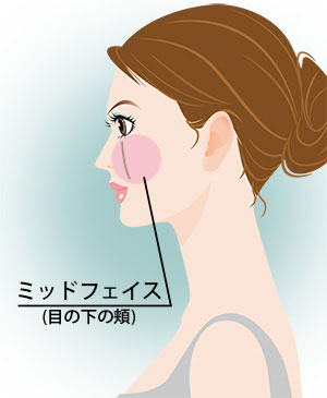 ミッドフェイス