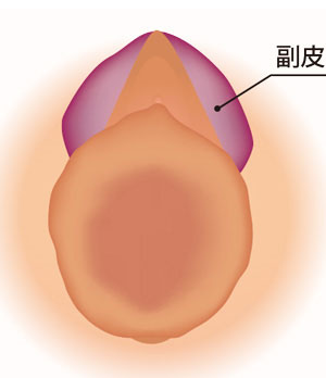 副皮