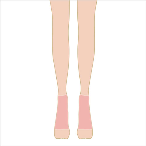 女性脱毛女性脱毛　