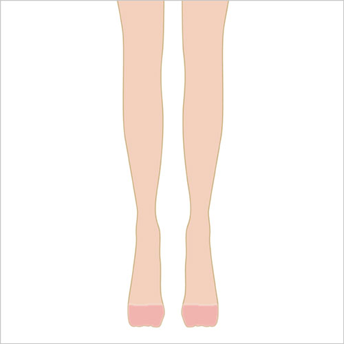 女性脱毛女性脱毛　