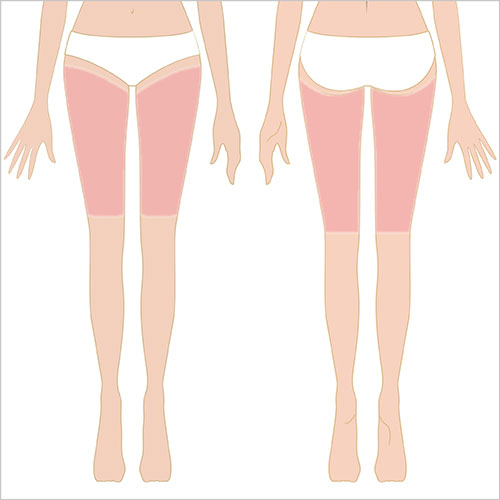 女性脱毛　両脚（大腿）
