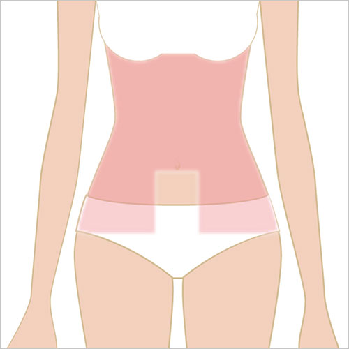 女性女性脱毛　