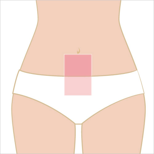 女性脱毛　へそ下（10cm×5cm）
