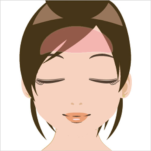 女性脱毛　額