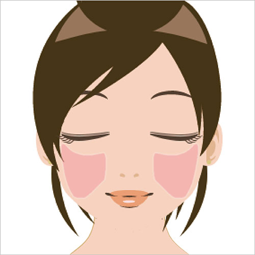 女性脱毛　頬