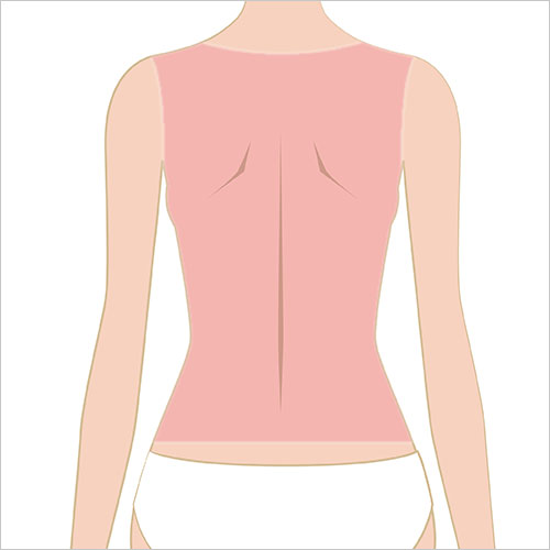 女性女性脱毛　