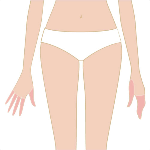 女性脱毛　両手の指