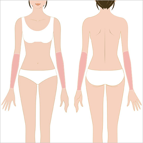 女性脱毛　前腕