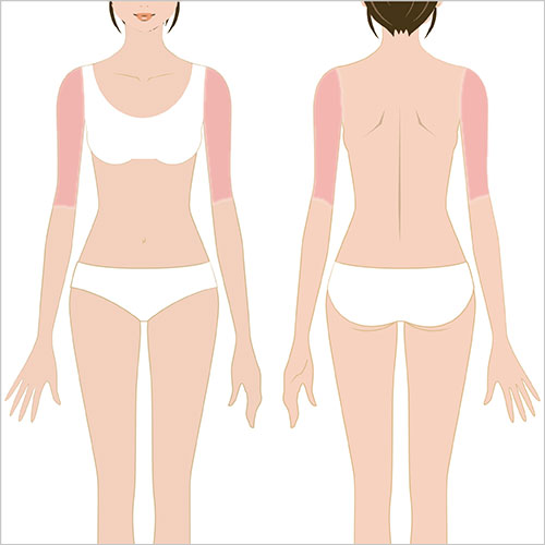 女性脱毛　上腕