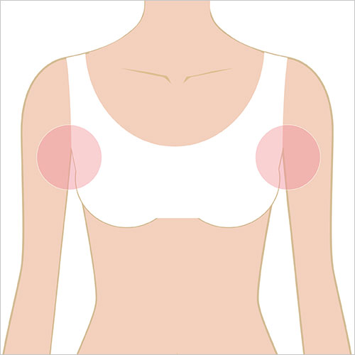 女性脱毛　ワキ