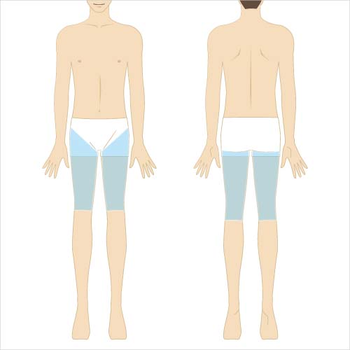 男性脱毛　両脚（大腿）