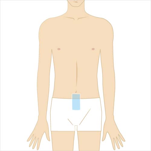 男性脱毛　へそ下（10cm×5cm）