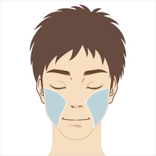 男性脱毛　頬