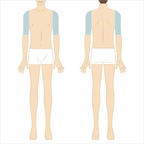 男性脱毛　上腕