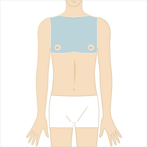 男性脱毛　胸部
