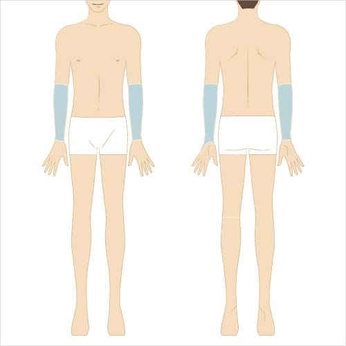 男性脱毛　前腕