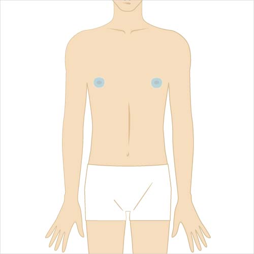 男性脱毛　男性脱毛　