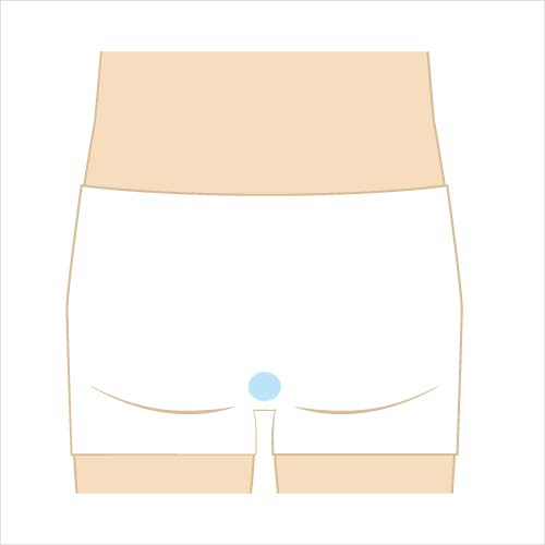 男性脱毛　Oライン