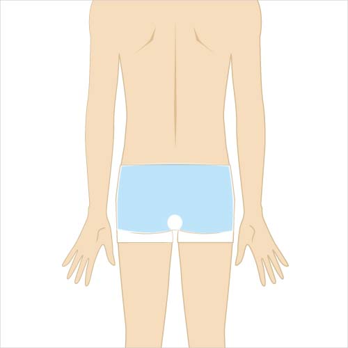 男性脱毛　お尻