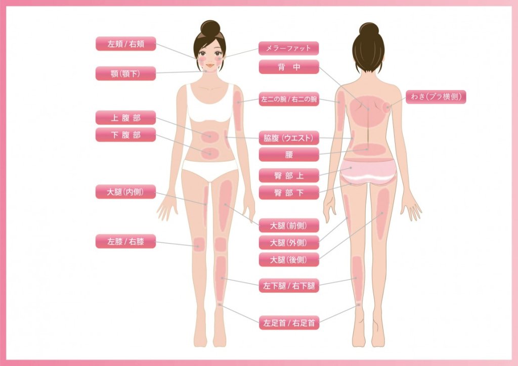 ベイザー脂肪吸引の適応部位