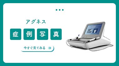 アグネス症例写真集