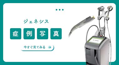 ジェネシス症例写真集