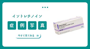 イソトレチノイン症例写真集
