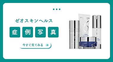 ゼオスキンヘルス症例写真集
